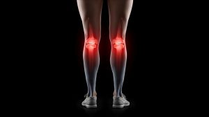 Lesiones de ligamento cruzado anterior