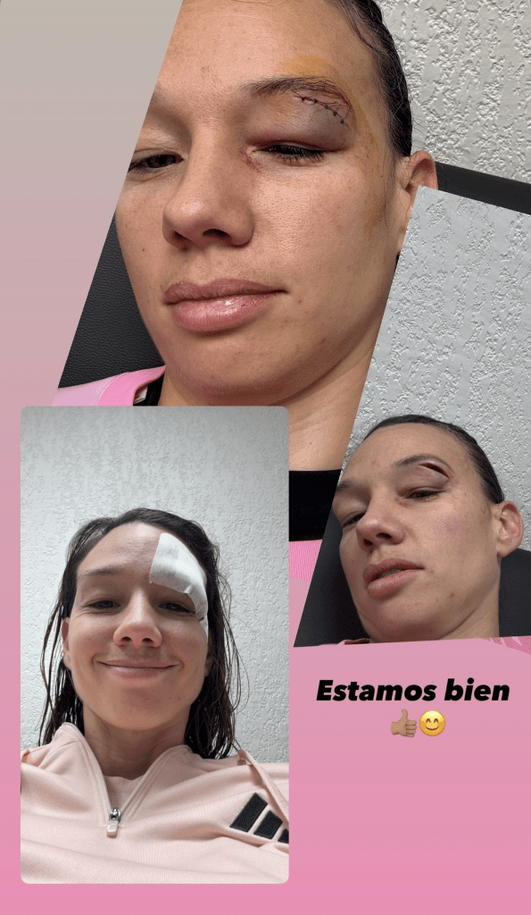 Christiane Endler lesión ceja