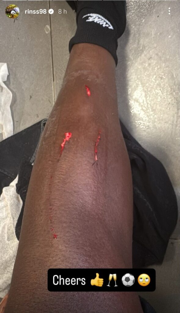 Pierna Rinsola Babajide